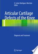 Articular cartilage defects of the knee : diagnosis and treatment / E. Carlos Rodríguez-Merchán, editor.