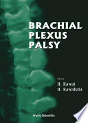 Brachial plexus palsy /