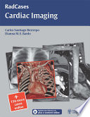 Cardiac imaging /