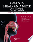 Cases in head and neck cancer : a multidisciplinary approach /