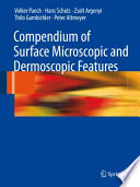 Compendium of surface microscopic and dermoscopic features /