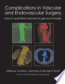 Complications in vascular and endovascular surgery : how to avoid them and how to get out of trouble /