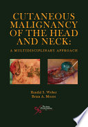 Cutaneous malignancy of the head and neck : a multidisciplinary approach /