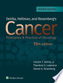 DeVita, Hellman, and Rosenberg's cancer : principles & practice of oncology /