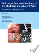 Endoscopic transnasal anatomy of the skull base and adjacent areas : a lab dissection and radiological atlas /