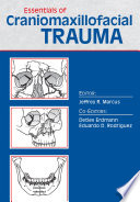 Essentials of craniomaxillofacial trauma /