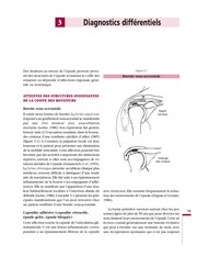 Guide pour le diagnostic des lésions musculo-squelettiques attribuables au travail répétitif. Louis Patry [and others].