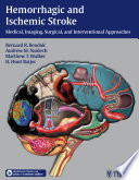 Hemorrhagic and ischemic stroke : medical, imaging, surgical and interventional approaches /