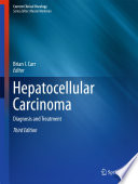 Hepatocellular carcinoma : diagnosis and treatment /