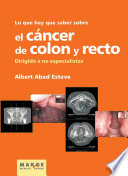 Lo que hay que saber sobre el cancer de colon y recto : dirigido a no especialistas /