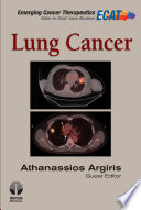 Lung cancer /