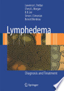 Lymphedema diagnosis and treatment /