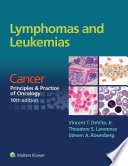 Lymphomas and leukemias /