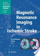 Magnetic resonance imaging in ischemic stroke /