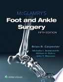 McGlamry's foot and ankle surgery. [edited by] Brian Carpenter, Michelle L. Butterworth, William D. Fishco, John T. Marcoux, Daniel F. Vickers.