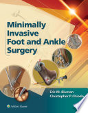 Minimally invasive foot and ankle surgery / editors, Eric M. Bluman, MD, Phd, Medical Director, Division of oFoot and Ankle, Brigham and Women's Hospital, Harvard Medical School, Boston, Massachusetts, Christopher P. Chiodo, MD, Chief, Foot and Ankle Surgery Service, Brigham and Women's Hospital, Harvard Medical School, Boston, Massachusetts.