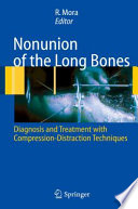 Nonunion of the long bones : diagnosis and treatment with compression-distraction techniques / Redento Mora (ed.) ; foreword by Dror Paley.