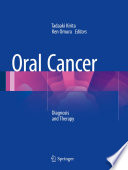 Oral cancer : diagnosis and therapy /