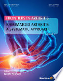 Rheumatoid arthritis : a systematic approach.