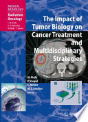 The impact of tumor biology on cancer treatment and multidisciplinary strategies /