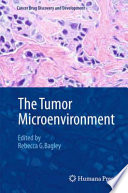 The tumor microenvironment /