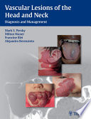 Vascular lesions of the head and neck : diagnosis and management /