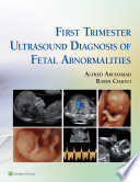 First trimester ultrasound diagnosis of fetal abnormalities /