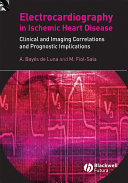 Electrocardiography in ischemic heart disease : clinical and imaging correlations and prognostic implications /