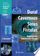 Dural cavernous sinus fistulas : diagnosis and endovascular therapy /