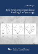 Real-time endoscopic image stitching for cystoscopy /