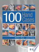 100 hand cases /