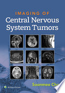 Imaging of Central Nervous System Tumors