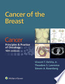 Cancer of the Breast : cancer, principles & practice of oncology /