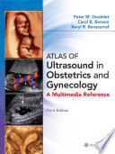 Atlas of ultrasound in obstetrics and gynecology : a multimedia reference /