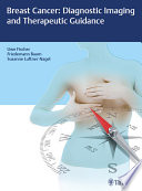 Breast cancer : diagnostic imaging and therapeutic guidance /