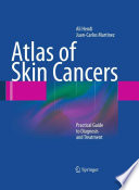 Atlas of skin cancers : practical guide to diagnosis and treatment /