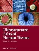 Ultrastructure atlas of human tissues / Fred E. Hossler ; cover design by Nicole Teut.