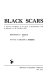 Black scars ; a rigorous investigation of the effects of discrimination, with an appendix on the Southern white / [by] Bertram P. Karon. Foreword by Silvan S. Tomkins.