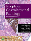 Neoplastic gastrointestinal pathology : an illustrated guide / Laura W. Lamps, Andrew M. Bellizzi, Wendy L. Frankel, Scott R. Owens and Rhonda K. Yantiss.