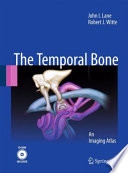 Temporal bone : an imaging atlas /