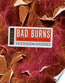 Bad burns : true survival stories /