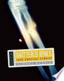 Shattered bones : true survival stories /