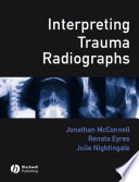 Interpreting trauma radiographs /