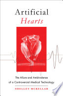 Artificial hearts : the allure and ambivalence of a controversial medical technology / Shelley McKellar.