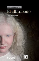 El albinismo /
