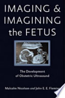 Imaging and imagining the fetus : the development of obstetric ultrasound /