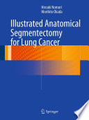 Illustrated anatomical segmentectomy for lung cancer / Hiroaki Nomori, Morihito Okada.