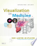 Visualization in medicine : theory, algorithms, and applications /