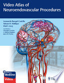 Video atlas of neuroendovascular procedures Leonardo Rangel-Castilla, Adnan H. Siddiqui, Elad I. Levy ; contributors, Giuseppe Lanzino, L. Nelson Hopkins, Jason M. Davies