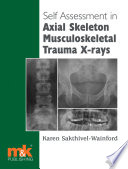 Self-assessment in axial skeleton musculoskeletal trauma X-rays /